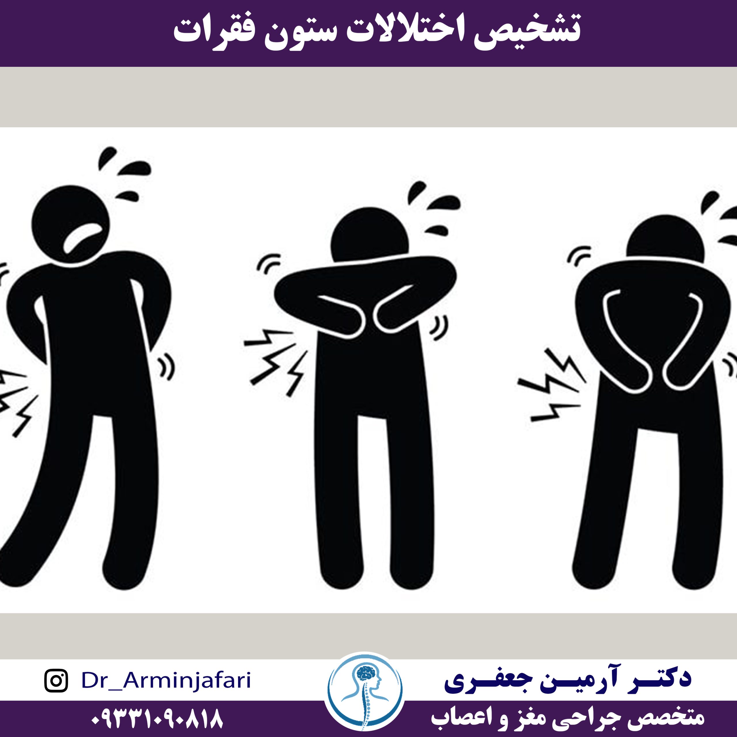 تشخیص اختلالات ستون فقرات