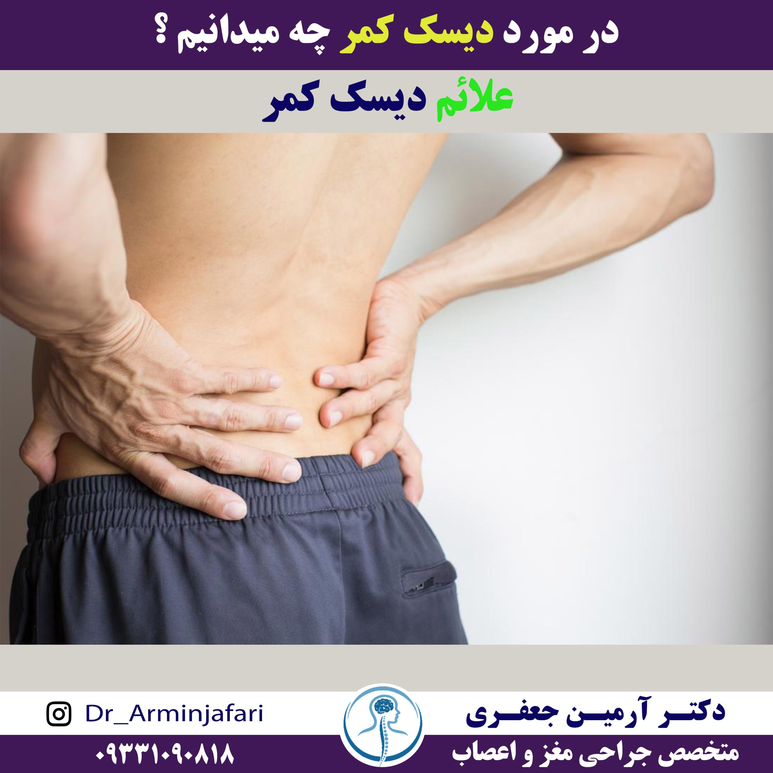 علائم دیسک کمر