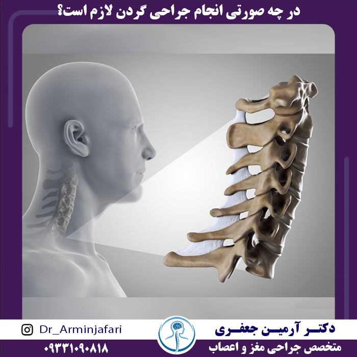 در چه صورتی انجام جراحی گردن لازم است؟