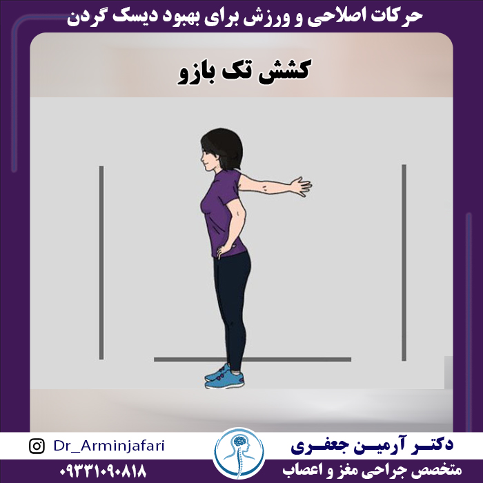 بهبود دیسک گردن با کشش تک بازو